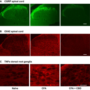 Figure-3-Immunocytochemical-localization-of-inflammatory-biomarkers-A-CGRP-and-B